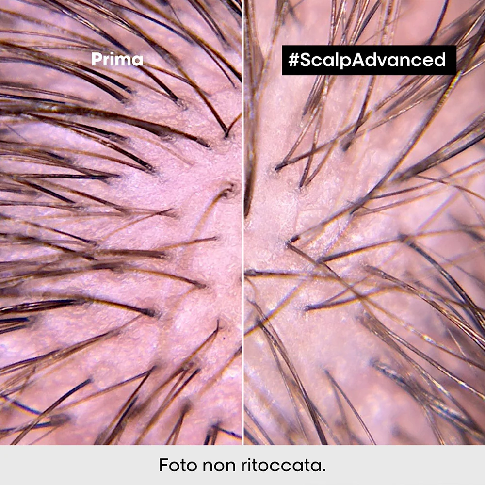 L'Oreal Professionel Scalp Advanced Anti-Discomfort Intense Soother 200ml - trattamento lenitivo - Image 2
