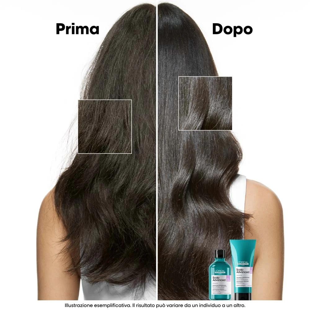 L'Oreal Professionnel Paris Scalp Advanced Anti-Discomfort Shampoo Refill 500ml -  eco-ricarica shampoo lenitivo - Image 3