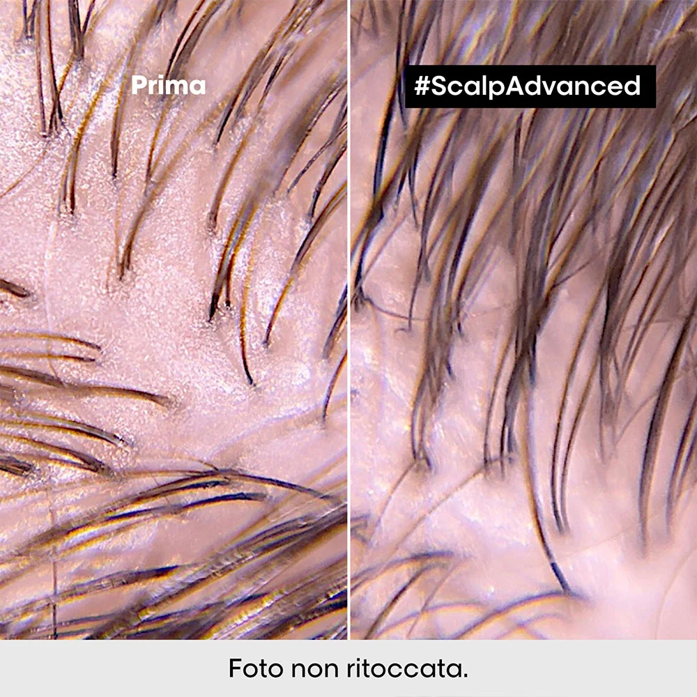 L'Oreal Professionnel Paris Scalp Advanced Anti-Oiliness 2in1 Deep Purifier Clay 250ml - shampoo & maschera purificante - Image 2